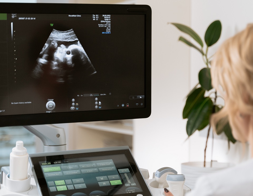 Ultrazvuk za vrijeme trudnoće