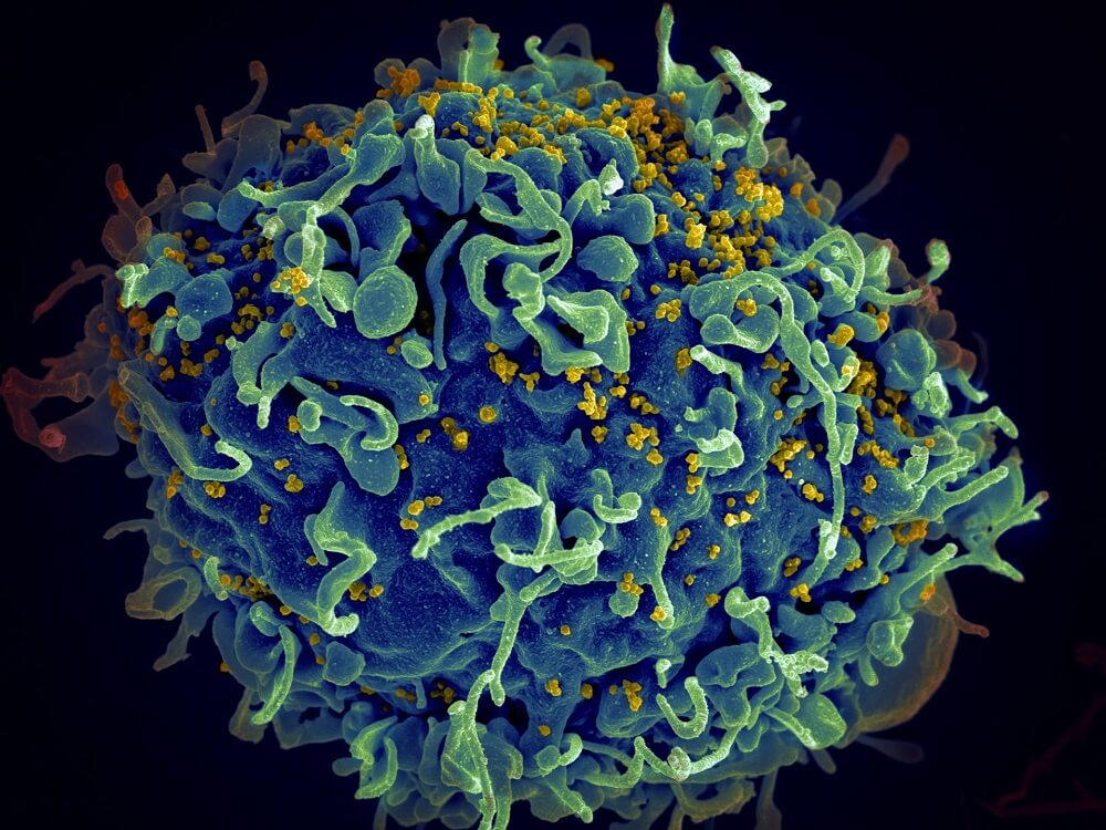 HIV i ljudska stanica