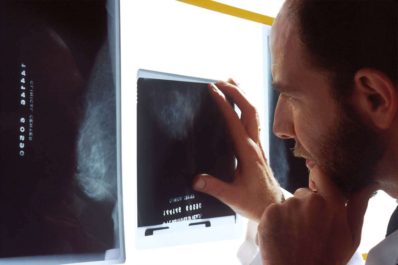 liječnik pregledava rendgensku snimku