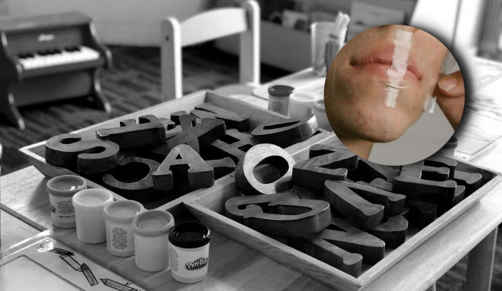 crno bijela pozadinska slika vrtića s igračkama na stolu i u okruglom slika selotejpa na ustima