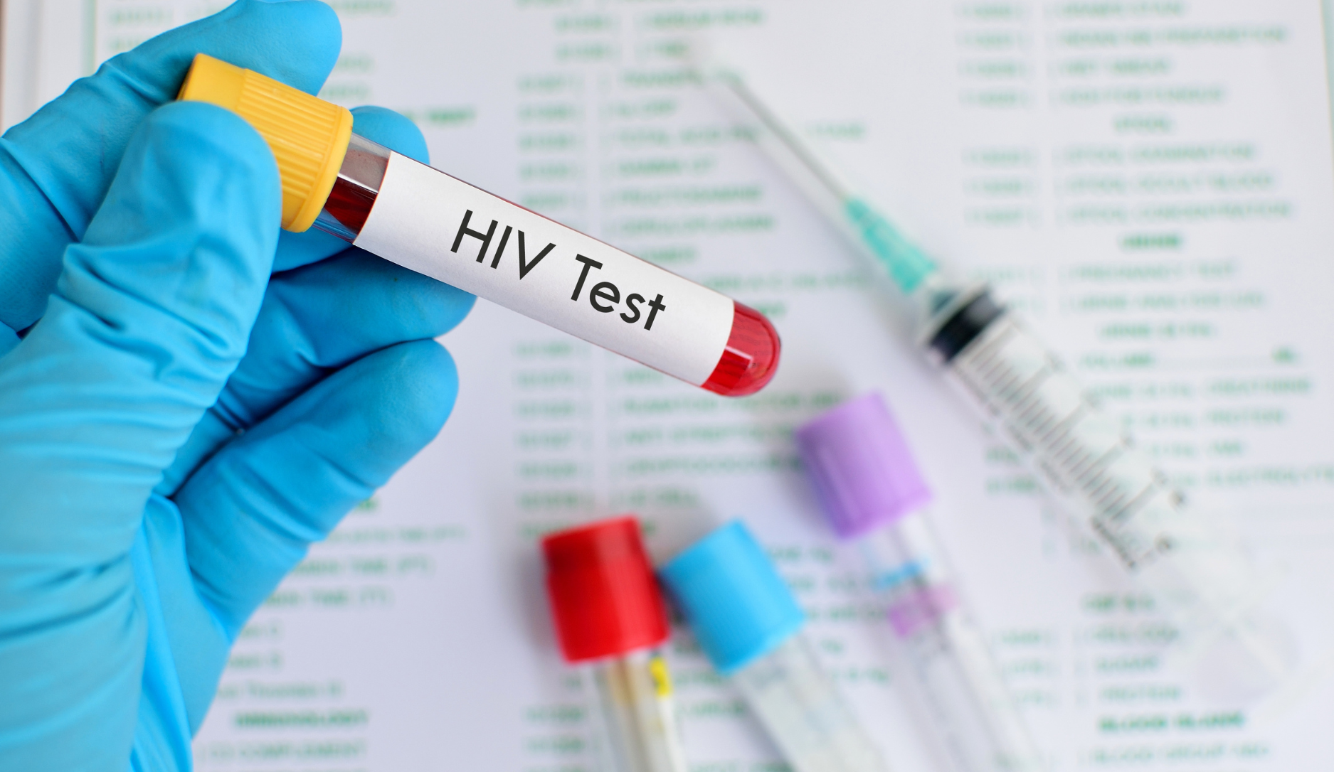 testiranje na HIV